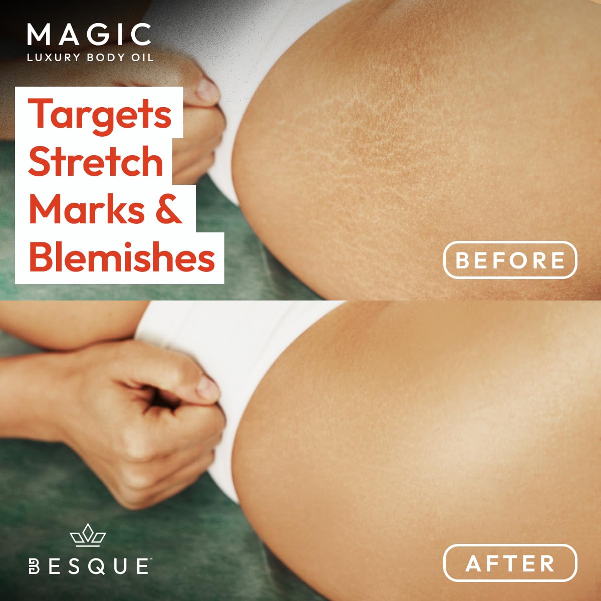BESQUE MAGIC ACEITE