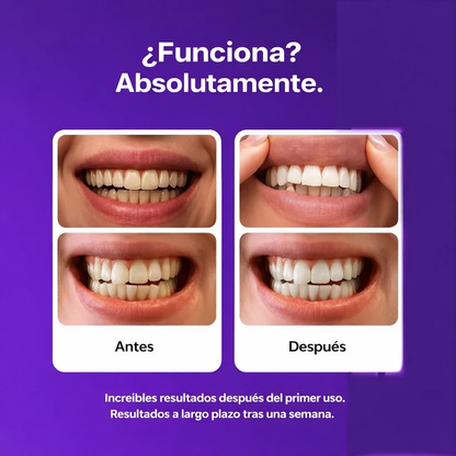 whitening strips